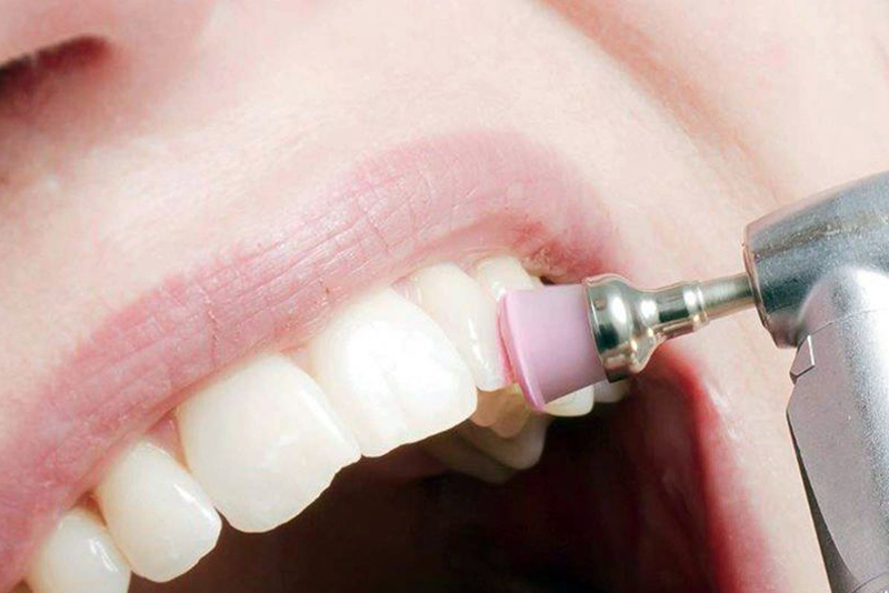 STUDIO DENTISTICO SARDELLA - TERAPIE - CHIRURGIA E PARODONTOLOGIA