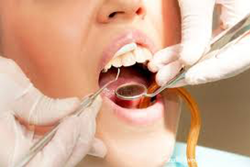 STUDIO DENTISTICO SARDELLA - TERAPIE - CONSERVATIVA E ENDODONZIA